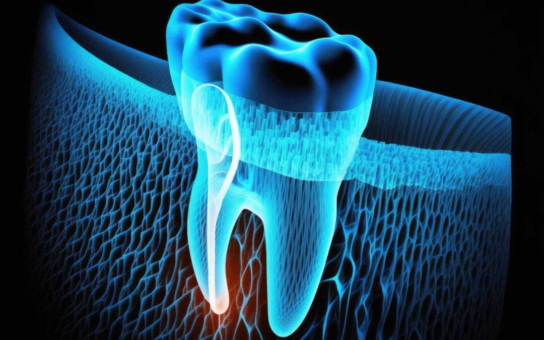 ¿Qué es la gingivectomía?