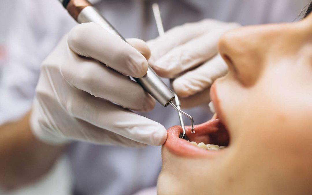 Cómo elegir a los mejores dentistas de Vitoria
