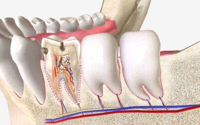 Partes anatómicas del diente