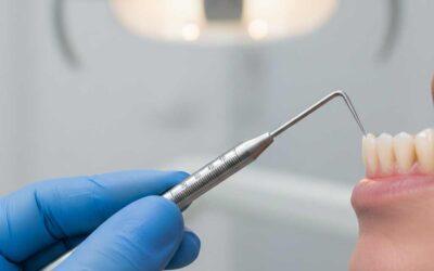 Qué es un tratamiento periodontal y cuándo lo necesitas