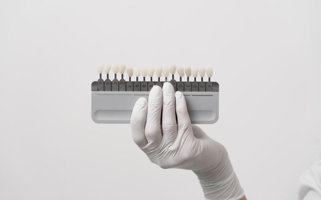 Carillas dentales en Vitoria: qué son, tipos y para quién están indicadas