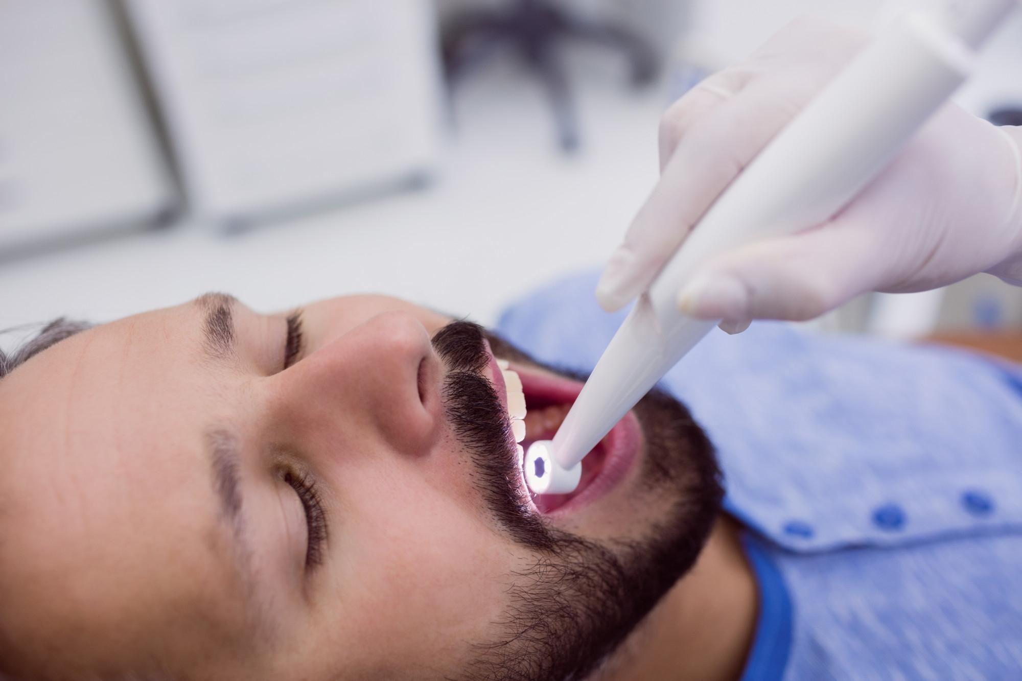 endodoncia-vitoria-klinika-b2 Endodoncia en Vitoria — Klinika B2 clínica dental
